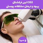 لیزر فرکشنال CO2